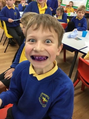 Sycamores teeth!