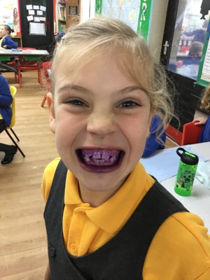 Sycamores teeth!